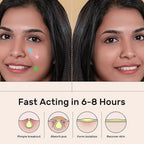 Star & Heart Pimple Patches — Hydrocolloid Acne Patches