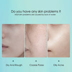 Hyaluronic Acid Sheet Mask Set — 10 Pack
