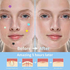 Star & Heart Pimple Patches — Hydrocolloid Acne Patches