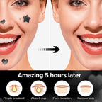 Star & Heart Pimple Patches — Hydrocolloid Acne Patches