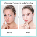 Hyaluronic Acid Sheet Mask Set — 10 Pack