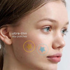 Star & Heart Pimple Patches — Hydrocolloid Acne Patches