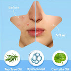 Star & Heart Pimple Patches — Hydrocolloid Acne Patches